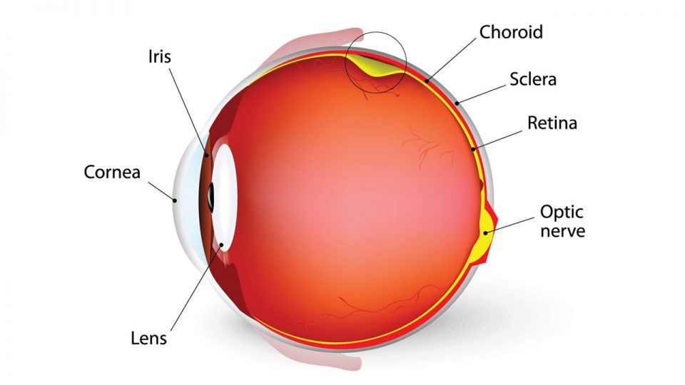 ¿Qué es la Retinopatía Diabética y cuál es la Importancia de prevenirla?