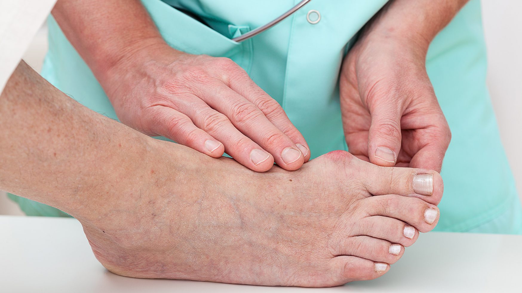 Estudio demuestra éxito en tratamiento para ulceras diabéticas en los pies