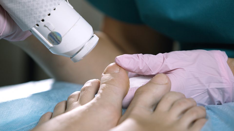 Importancia de visitar a su Podólogo para mantener un buen Cuidado de sus Pies