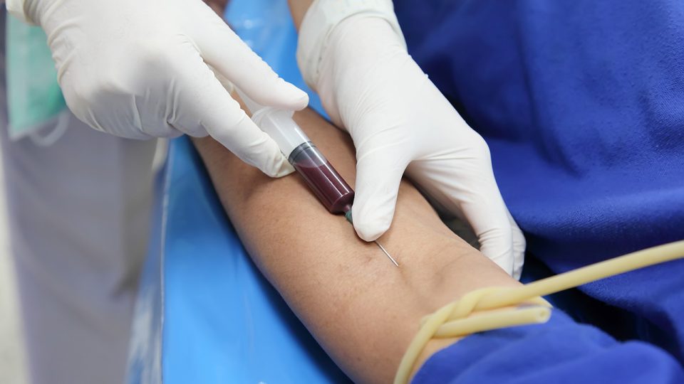 La Curva de Tolerancia a la Glucosa indica el riesgo de tener Diabetes