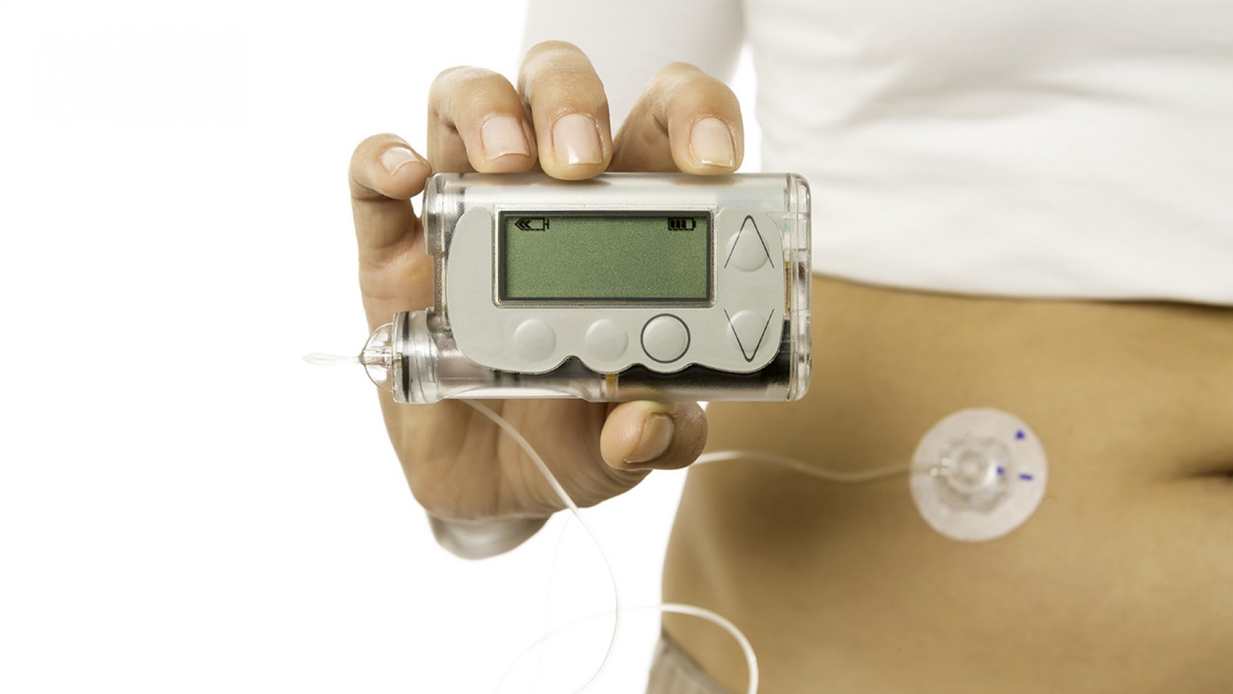 Avances Científicos y Tecnológicos en materia de Diabetes