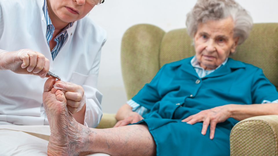 Si tiene Diabetes ¿Cómo debe Cortar sus Uñas, Tratar sus Callos y tener una Buena Higiene de sus Pies?