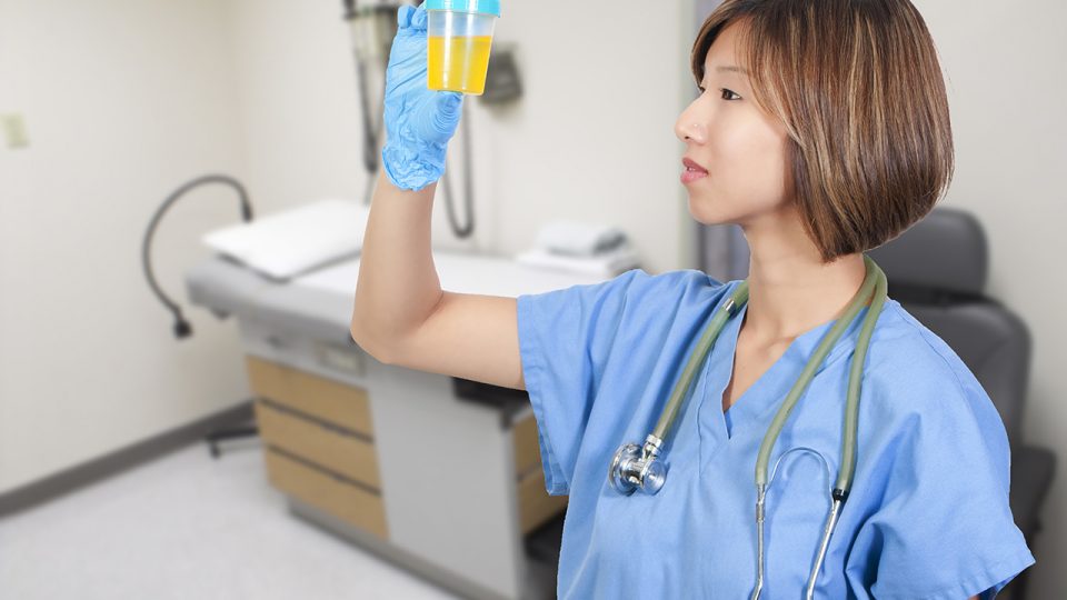 Exámenes para chequear Función Renal en personas con Diabetes